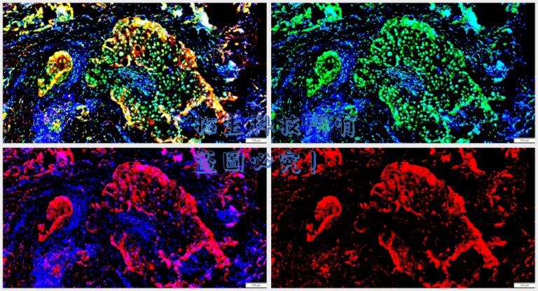 深度解析免疫螢光染色技術的應用與優勢